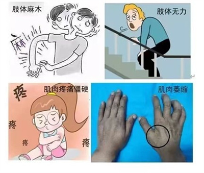 肌电图2.jpg